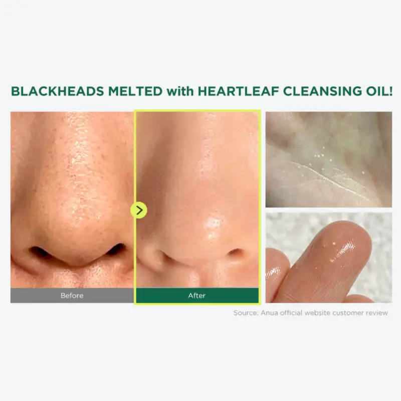 PORE CONTROL CLEANSING OIL