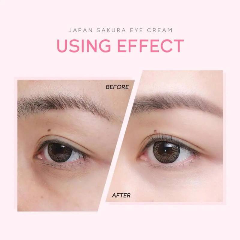 EYE CREAM