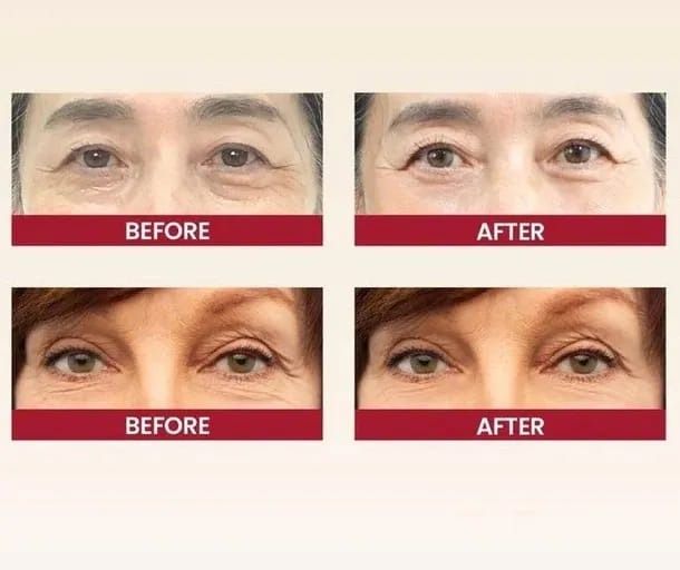 K-SECRET SEOUL 1988 Eye Cream: Retinal Liposome 2% + Fermented