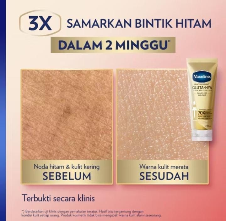 Gluta-Hya Serum Burst UV Lotion (Varian: Flawless Bright).