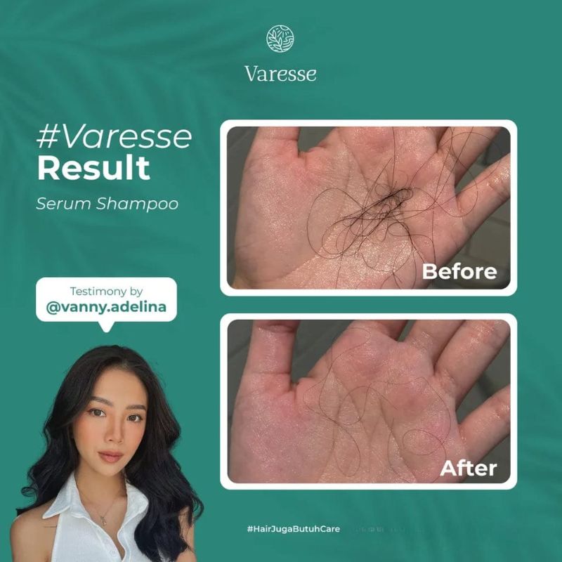 Varesse Serum Shampoo Hair Loss Defense dengan Herbavit Serum 2 IN 1